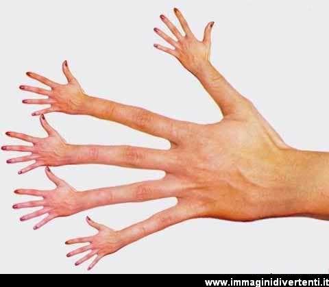 Foto Divertente: Mani attaccate ad ogni dito di una mano