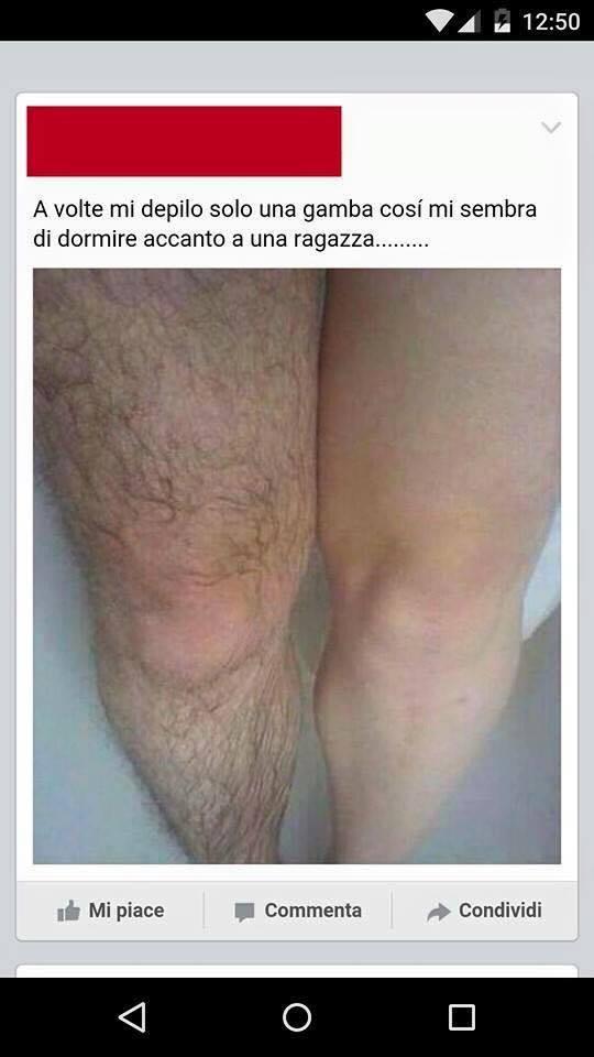 Foto Divertente: Una gamba pelosa ed una depilata