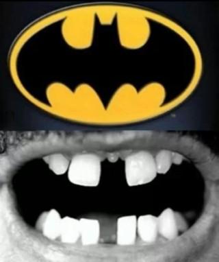 Foto dei denti uguale allo stemma di batman