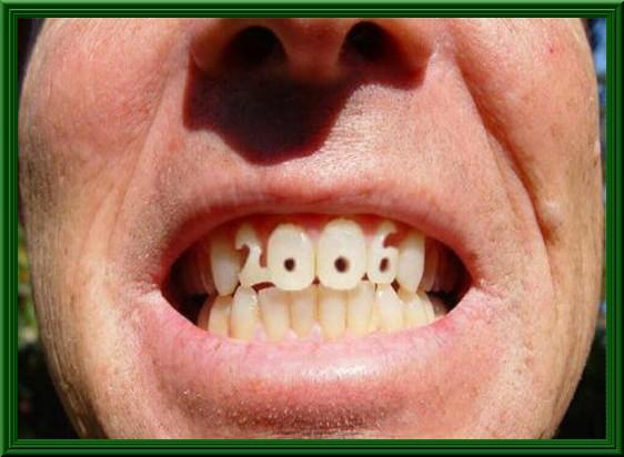 Foto Divertente: Denti a forma di 2006